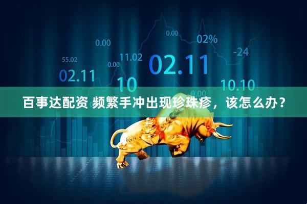 百事达配资 频繁手冲出现珍珠疹，该怎么办？
